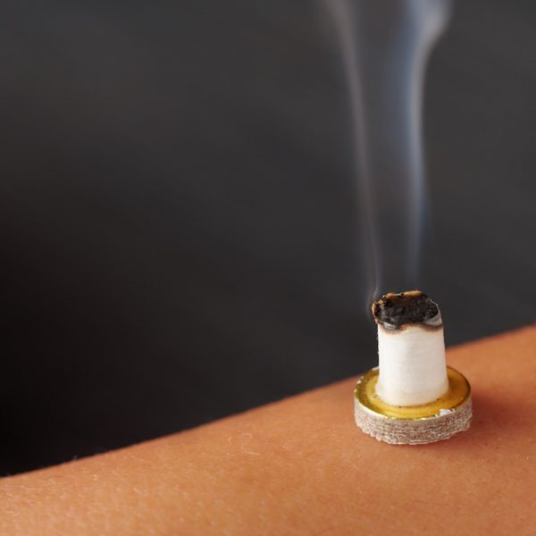 Moxibustion Therapy: Moxibustion Therapy releases toxins from your body and increases health
